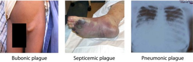 plague Yersina pestis; microbiome.chunlab.com/en/strain-of-the-month-en/yersinia-pestis-2/